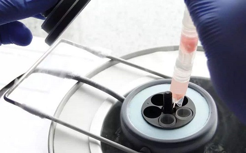 試管嬰兒大概要多少錢呢