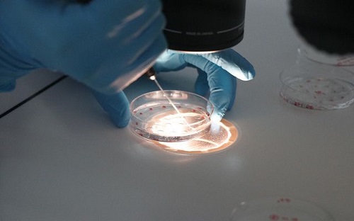 俄羅斯試管嬰兒如何?