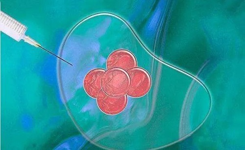 人工受孕和試管嬰兒哪個(gè)好