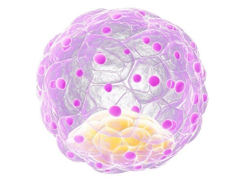 泰國(guó)做試管嬰兒要經(jīng)歷哪些步驟