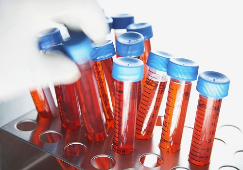 泰國試管前需要做好哪些準(zhǔn)備