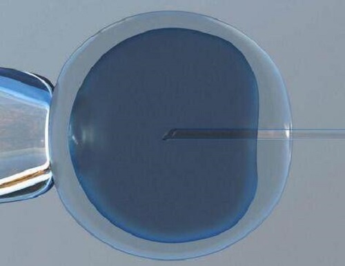 選擇去泰國做試管的原因是什么呢